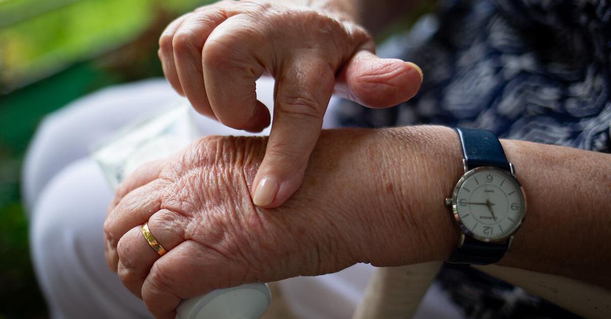 ρευματοειδή αρθρίτιδα