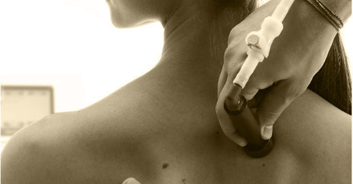 Πρήξιμο μυών και φλεγμονή: Οδηγός για φυσικοθεραπεία