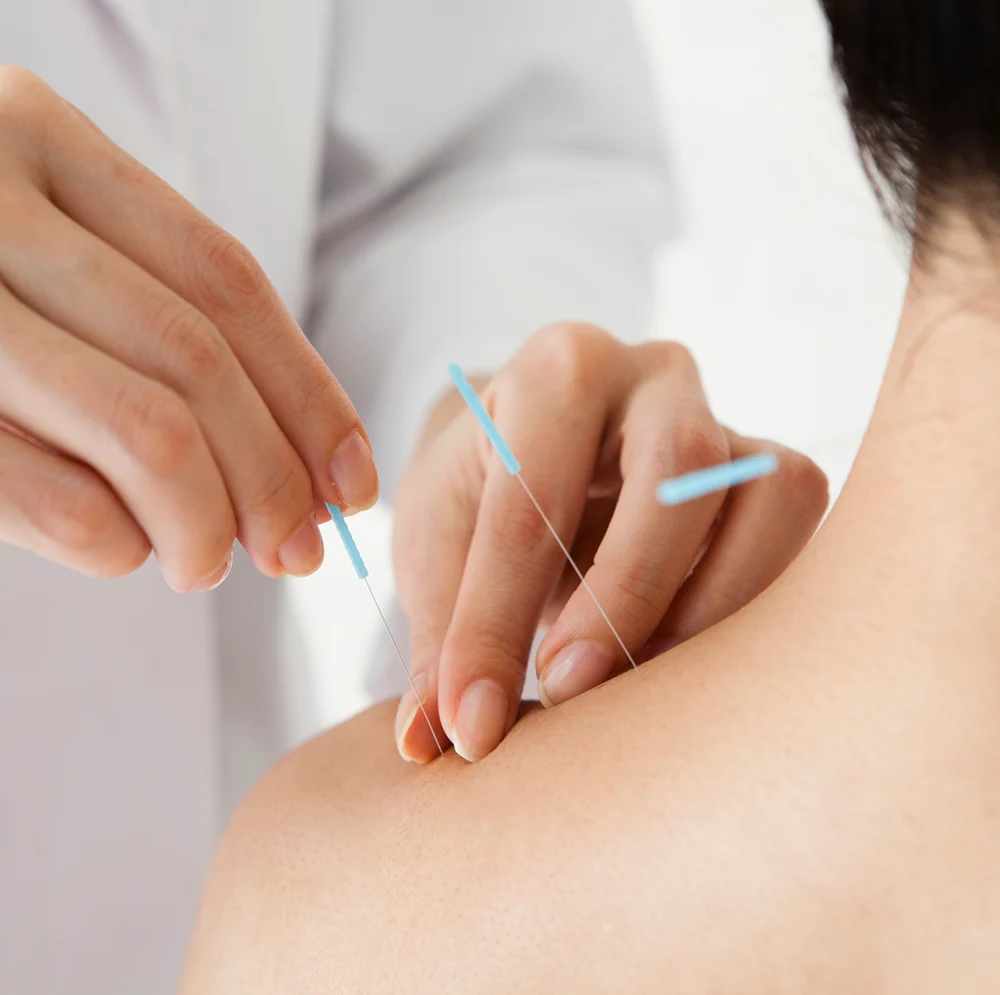Βελονισμός - acupuncture-joint-pain - Human Kinetics - Human Kinetics Βελονισμός - acupuncture-joint-pain