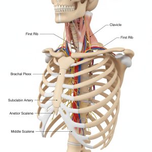 Θωρακικό Σύνδρομο Εξόδου