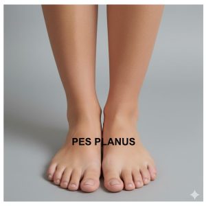 Πλατυποδία